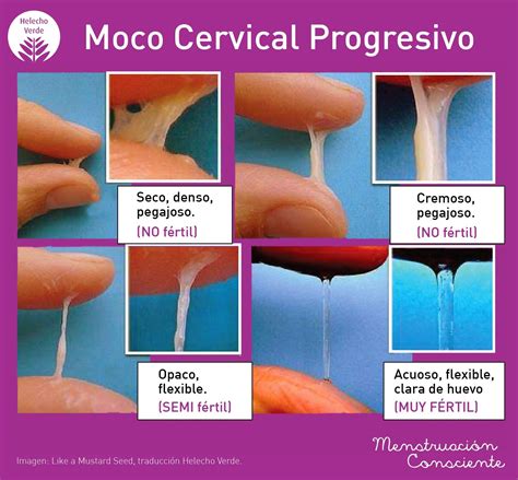 billings desventajas|Método Billings o del moco cervical: cómo es, para。